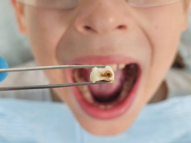Best Emergency Dentist for Kids  in New Hampton, IA